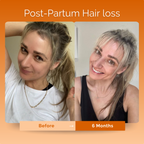 KIRIGLOW™ | Keratin Hair Growth Supplement