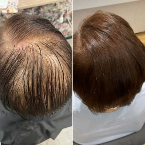 KIRICARE™ | Glow Pro Bundle – Your Hair Growth Starter System